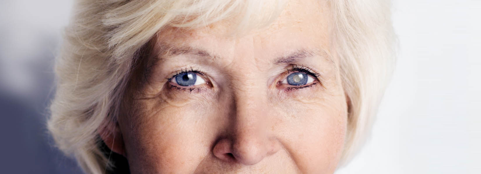 Cataract Surgery in Spring Branch
